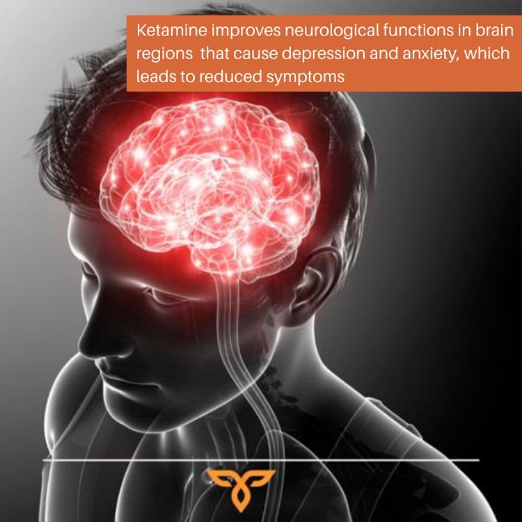 Ketamine treatment for depression and mental health